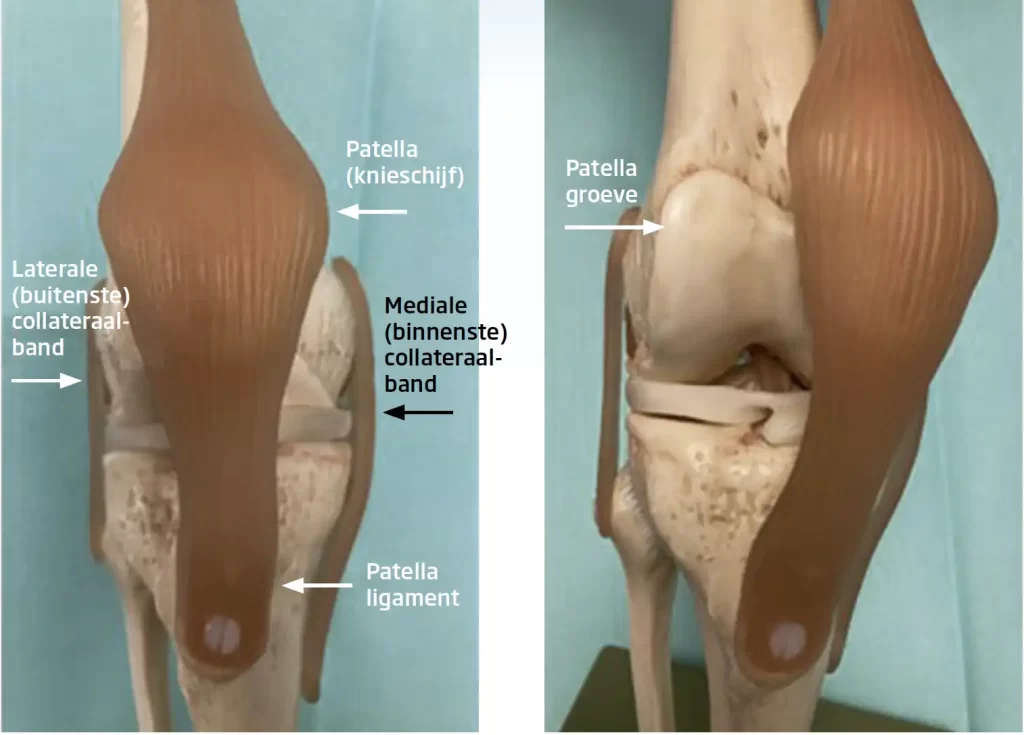 mediale-patella-luxatie